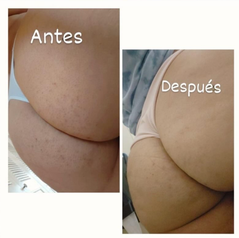 Combo de glúteos